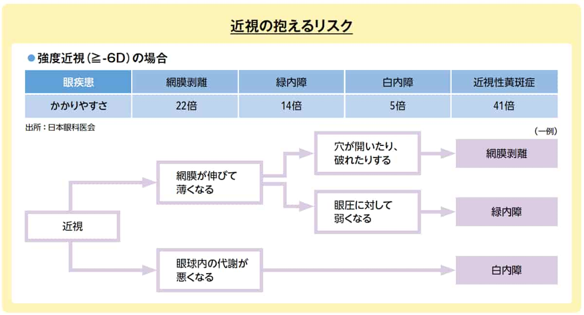 近視の抱えるリスク