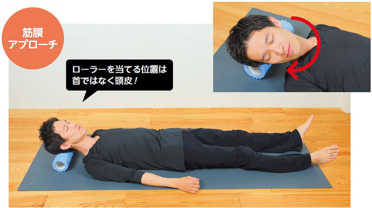 筋膜アプローチ