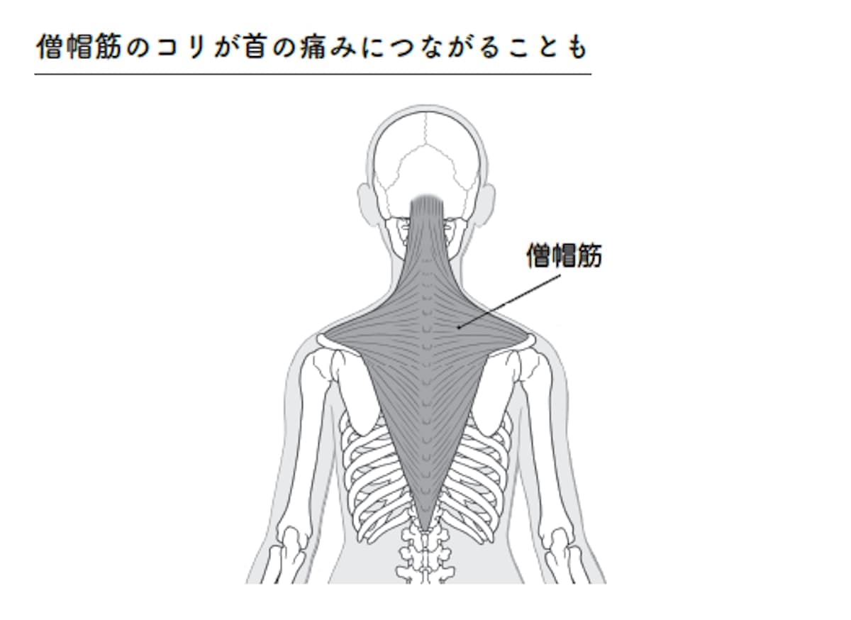 僧帽筋のコリが首の痛みにつながることも