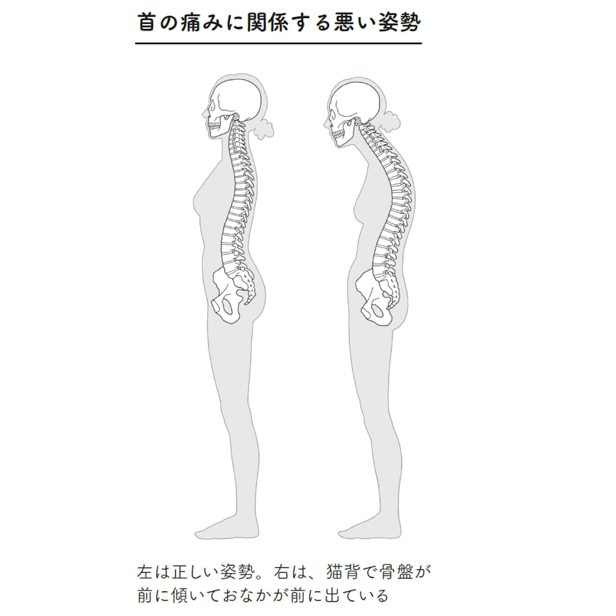 首の痛みに関係する悪い姿勢